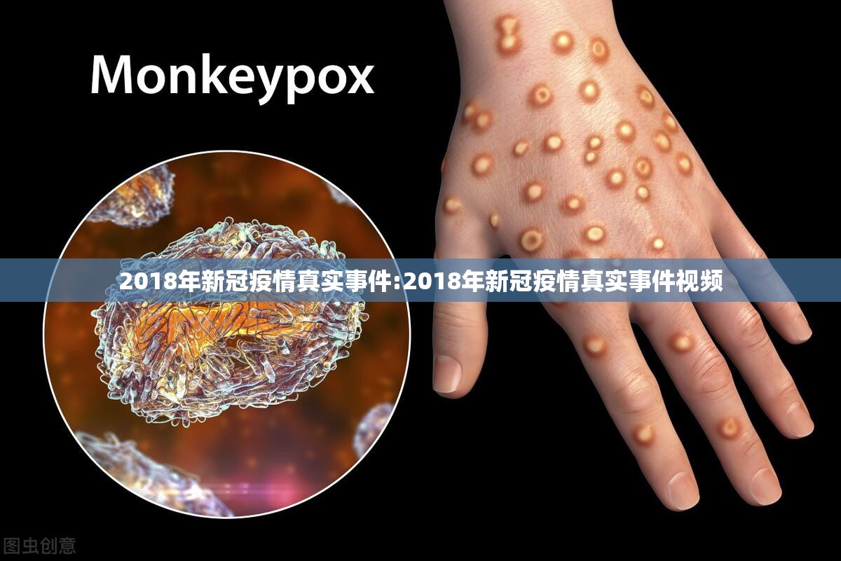 2018年新冠疫情真实事件:2018年新冠疫情真实事件视频