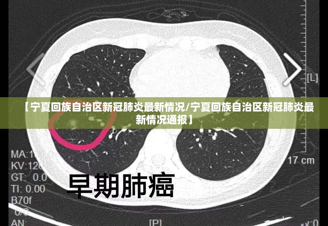 【宁夏回族自治区新冠肺炎最新情况/宁夏回族自治区新冠肺炎最新情况通报】